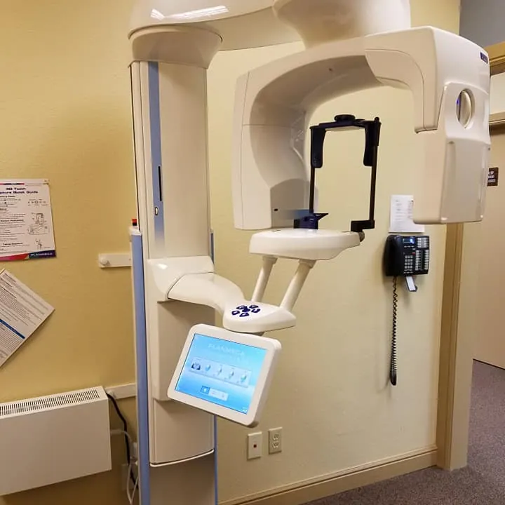 3D cone beam CT scanner at Grinview Smiles